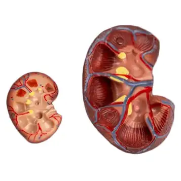 VERIMP Njurmodell Mänskligt Inre Organ Modell I Naturlig Storlek Njurmodell 2 Delar Njuranatomimodell, Naturlig Stor Frisk Njure Anatomisk Modell For Läkare Utbildningsverktyg For Kontor